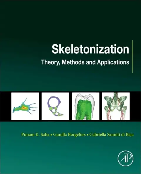Cover of Skeletonization
