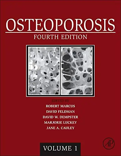 Cover of Osteoporosis