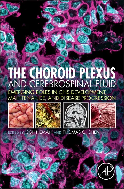 Cover of The Choroid Plexus and Cerebrospinal Fluid
