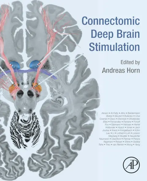Cover of Connectomic Deep Brain Stimulation