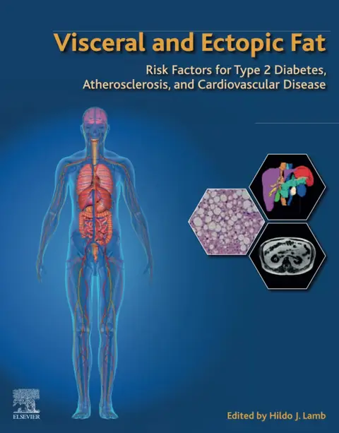 Cover of Visceral and Ectopic Fat