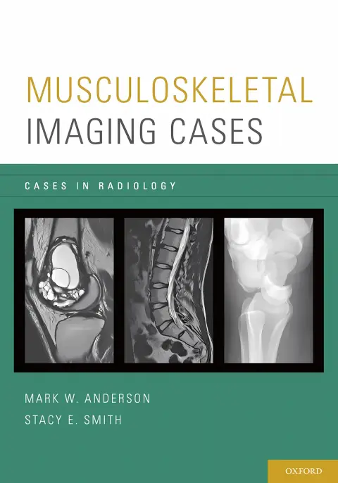 Cover of Musculoskeletal Imaging Cases