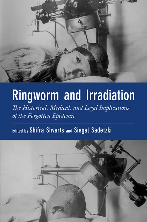 Cover of Ringworm and Irradiation