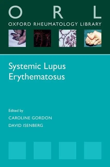 Cover of Systemic Lupus Erythematosus