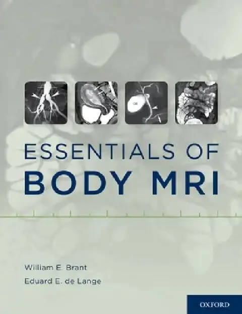 Cover of Essentials of Body MRI