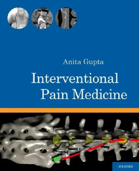 Cover of Interventional Pain Medicine