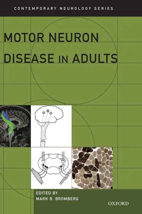 Cover of Motor Neuron Disease in Adults
