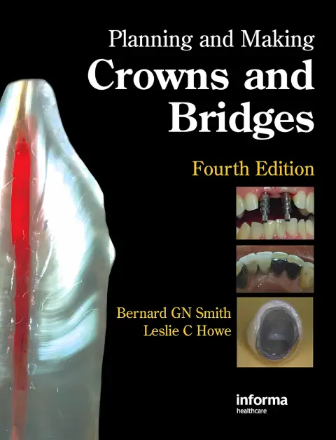 Cover of Planning and Making Crowns and Bridges