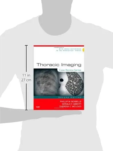 Cover of Thoracic Imaging