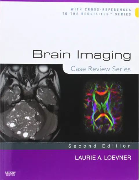Cover of Brain Imaging