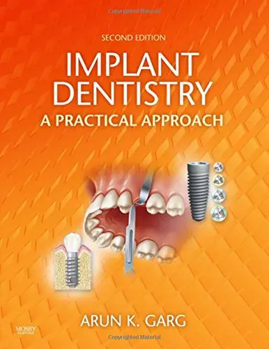 Cover of Implant Dentistry