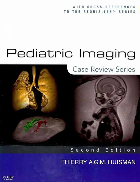 Cover of Pediatric Imaging
