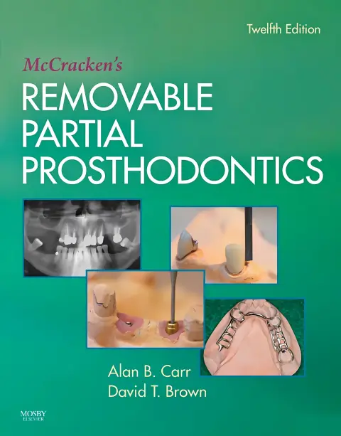Cover of McCracken’s Removable Partial Prosthodontics, 12e