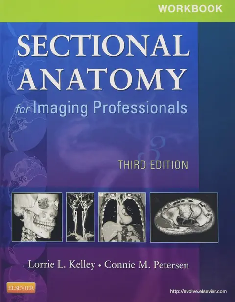 Cover of Workbook for Sectional Anatomy for Imaging Professionals