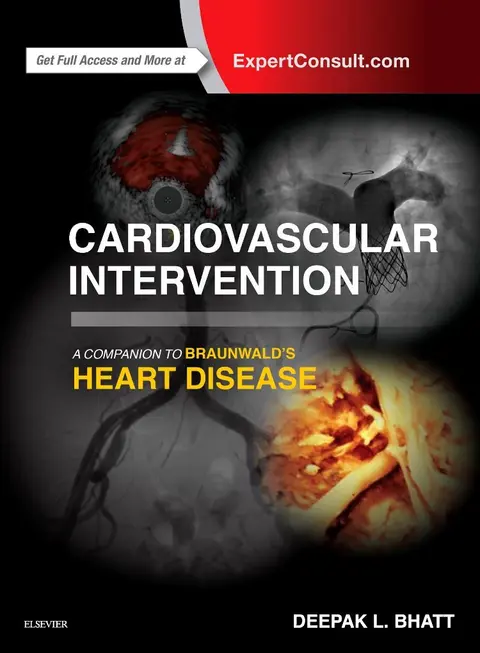 Cover of Cardiovascular Intervention
