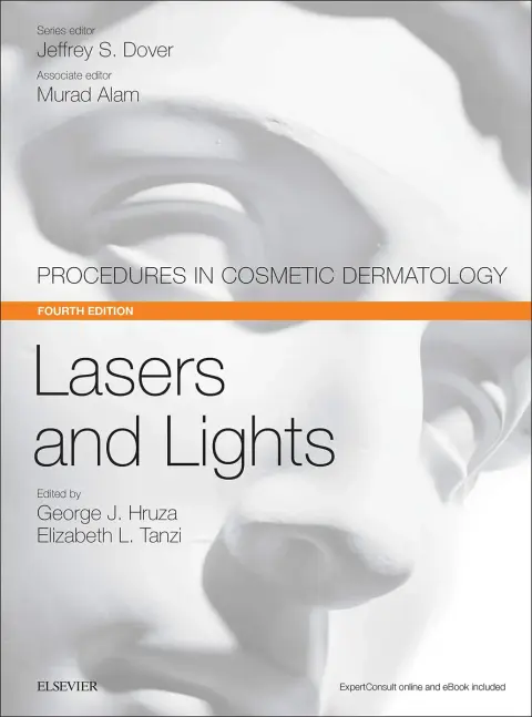 Cover of Lasers and Lights
