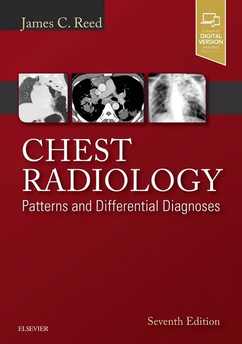 Cover of Chest Radiology
