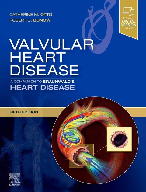 Cover of Valvular Heart Disease
