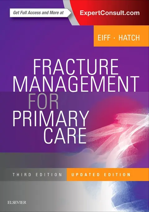 Cover of Fracture Management for Primary Care
