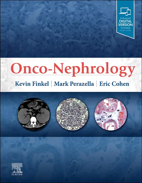 Cover of Onco-Nephrology - 1E