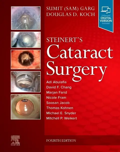 Cover of Steinert's Cataract Surgery
