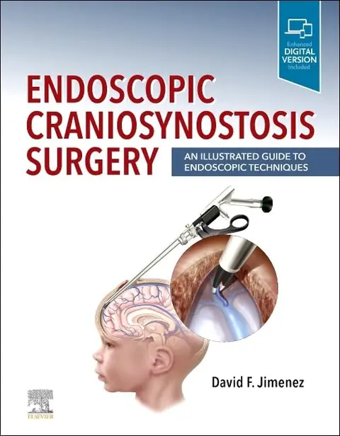 Cover of Endoscopic Craniosynostosis Surgery