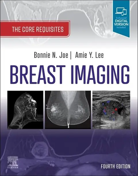 Cover of Breast Imaging-4E