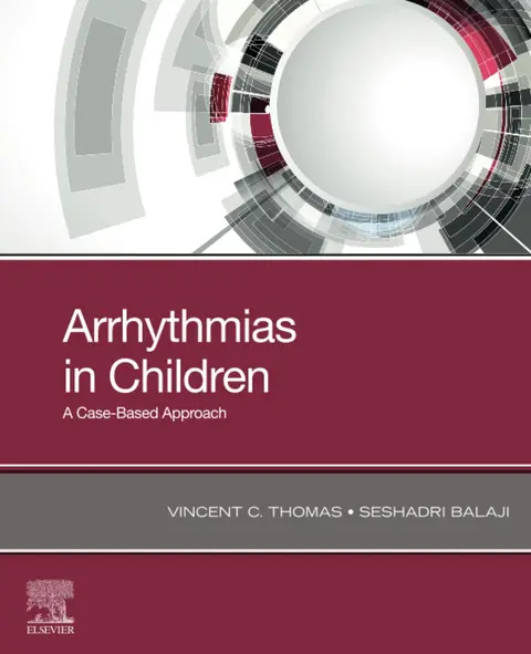 Cover of Arrhythmias in Children