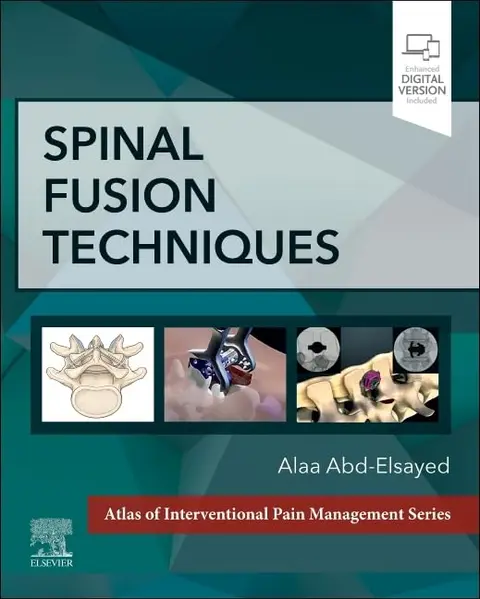 Cover of Spinal Fusion Techniques