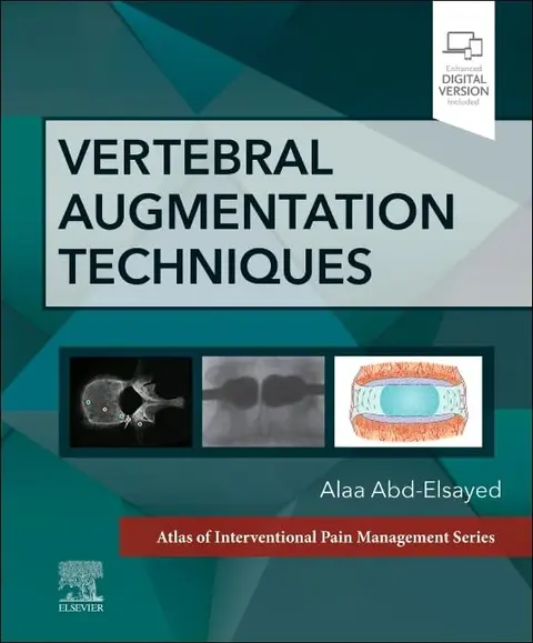 Cover of Vertebral Augmentation Techniques