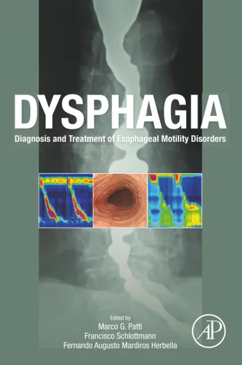 Cover of Dysphagia