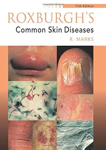 Cover of Roxburgh's Common Skin Diseases