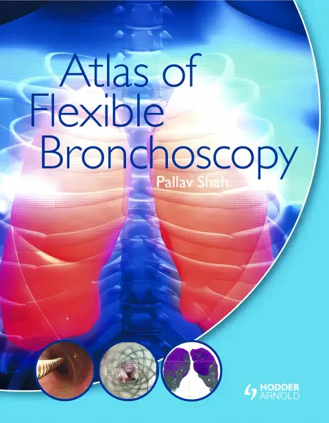 Cover of Atlas of Flexible Bronchoscopy