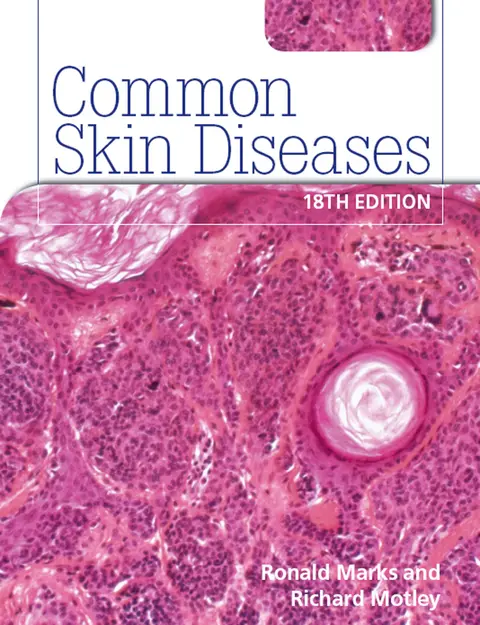 Cover of Common Skin Diseases