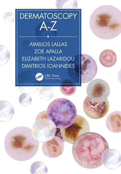 Cover of Dermatoscopy A-Z