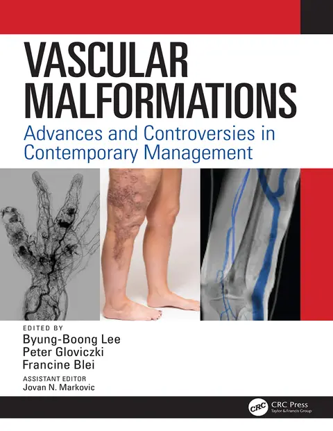 Cover of Vascular Malformations