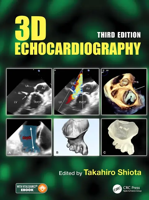 Cover of 3D Echocardiography