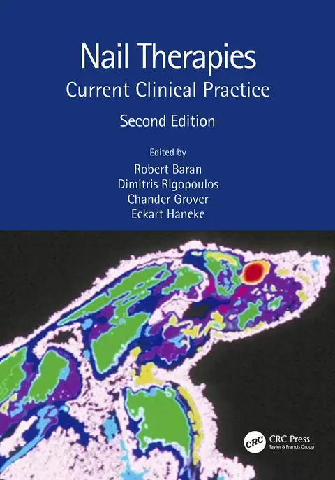 Cover of Nail Therapies Current Clinical Practice 2Ed