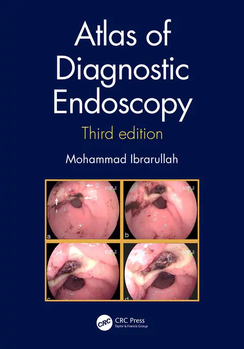 Cover of Atlas of Diagnostic Endoscopy 3Ed