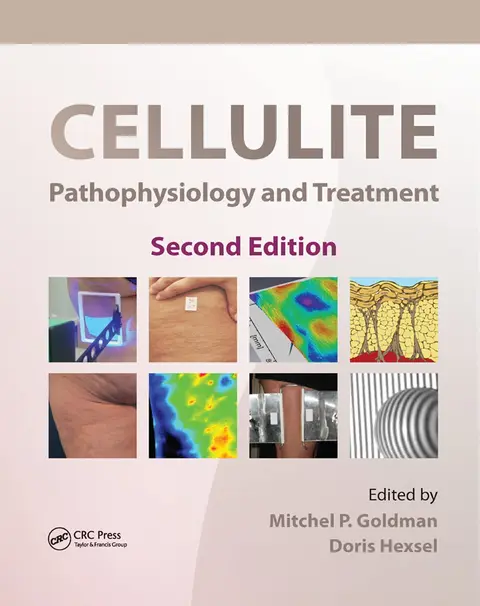 Cover of Cellulite