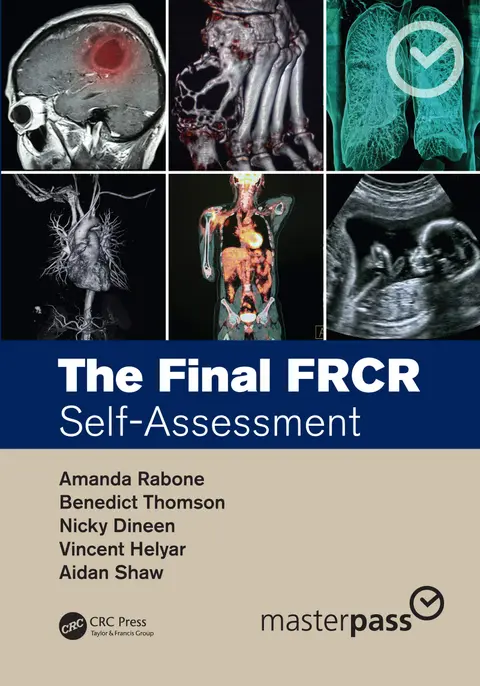 Cover of The Final FRCR