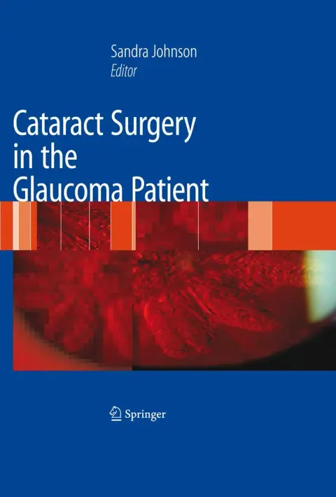 Cover of Cataract Surgery in the Glaucoma Patient