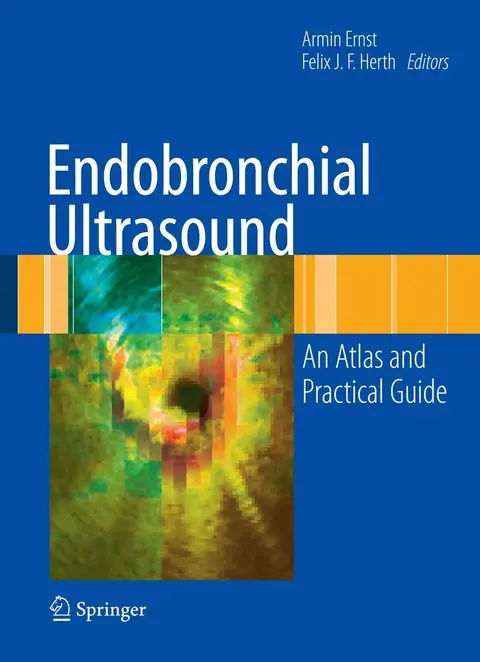 Cover of Endobronchial Ultrasound