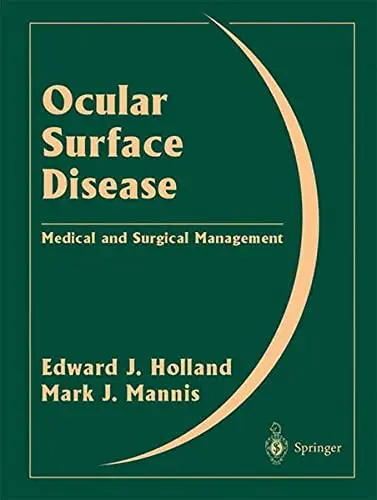 Cover of Ocular Surface Disease