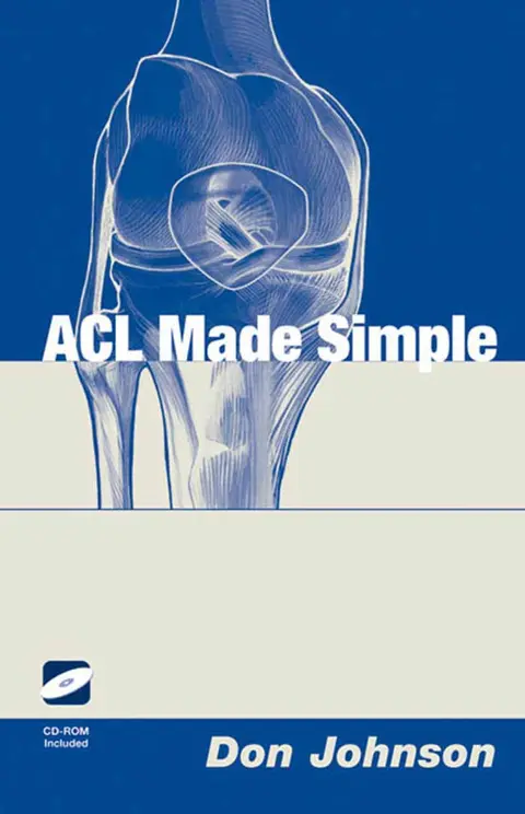 Cover of Acl Made Simple