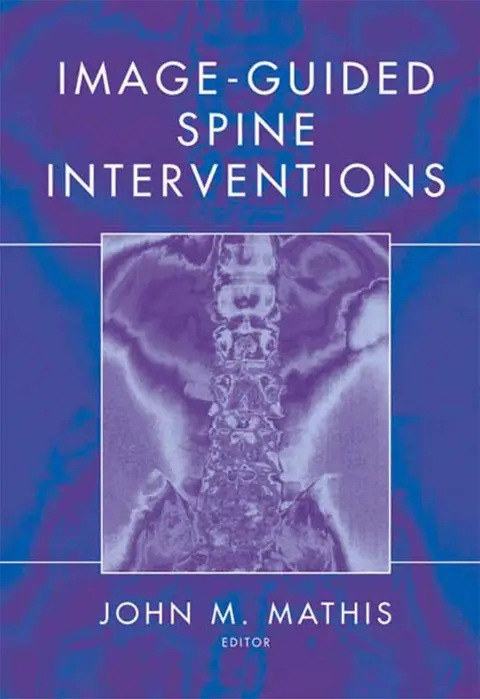 Cover of Image-guided Spine Interventions