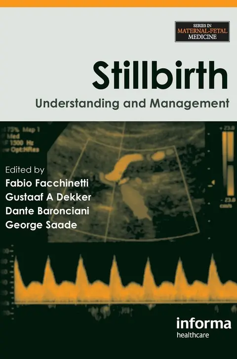 Cover of Stillbirth