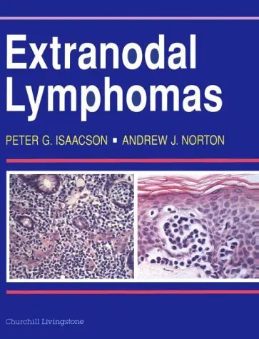 Cover of Extranodal Lymphomas