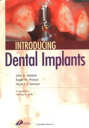 Cover of Introducing Dental Implants