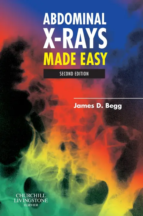 Cover of Abdominal X Rays Made Easy 2Ed